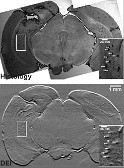 Images of the brain of a transgenic mouse